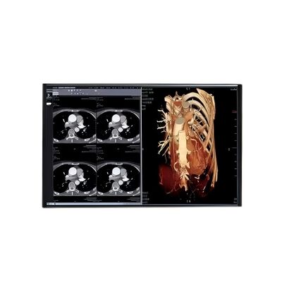 Good price 10.36 Inch TFT LCD Touch Screen with 1200x2000 Resolution and 10 Point Touch MIPI Display Module online
